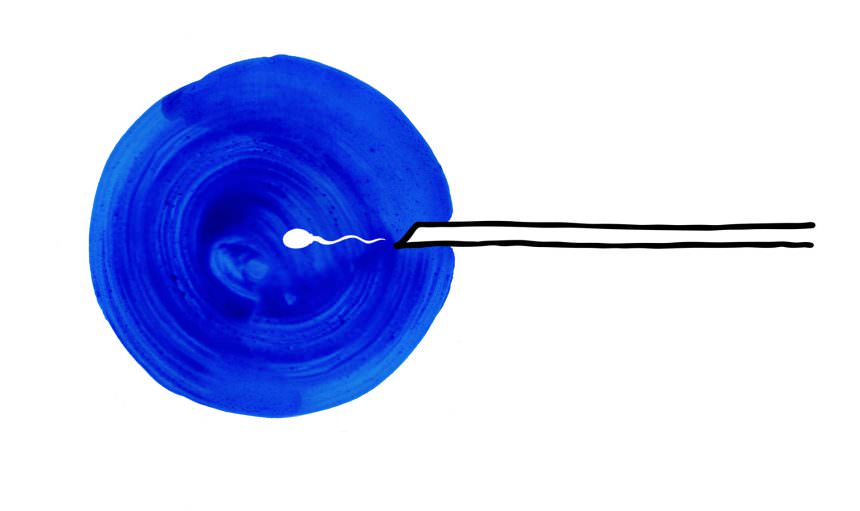 3. La inseminación 3. La inseminación