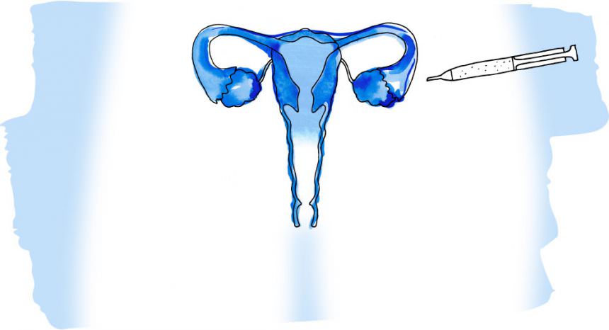 1. Estimulación del ovario 1. Estimulación del ovario